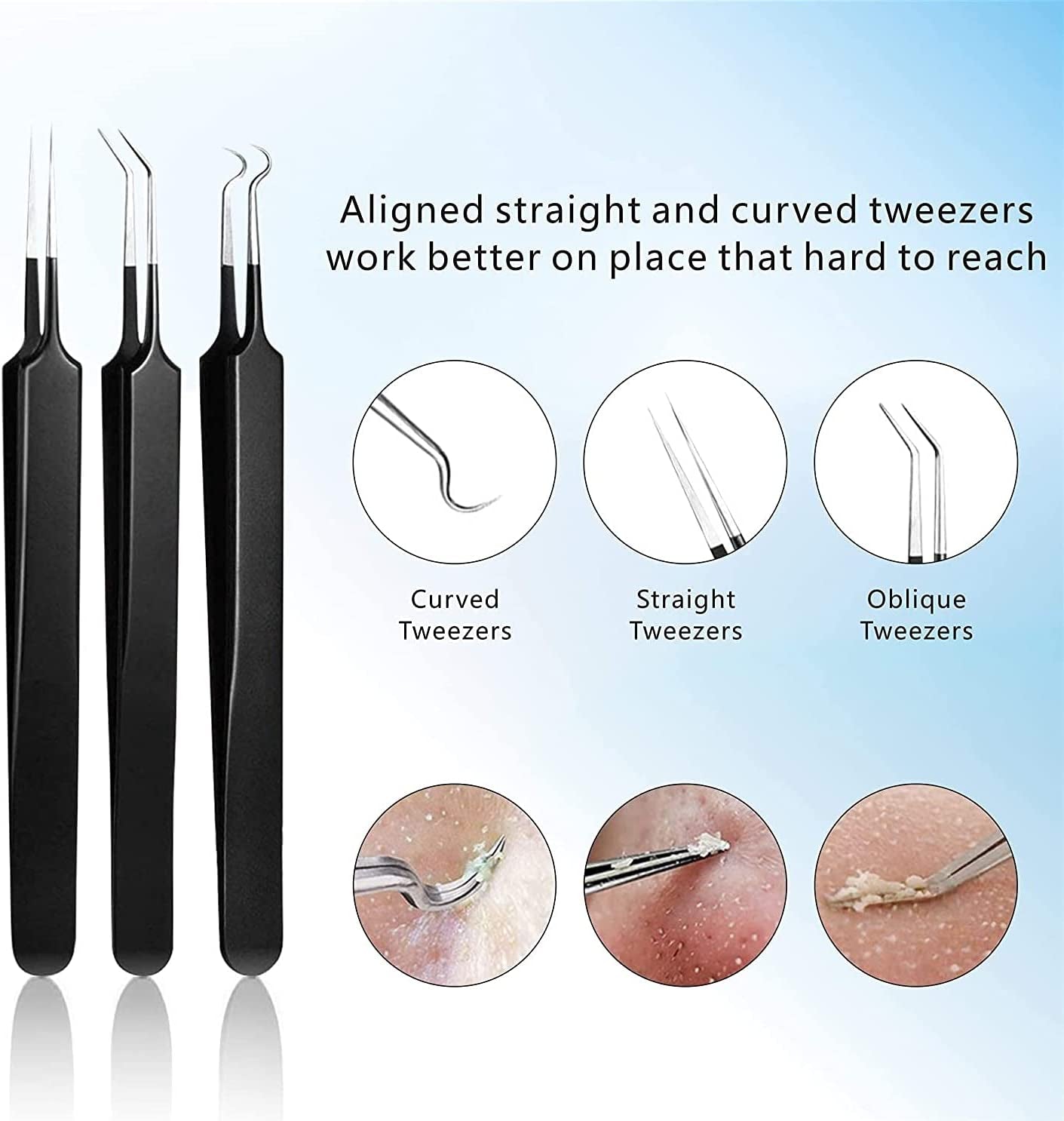 Pimple Popper Tool Kit 11 Pcs, Ybaoo Blackhead Remover Pimple Extractor Tools with Metal Case for Quick and Easy Removal of Blackheads,Pimples,Whiteheads,Zit Popper,Forehead,Facial and Nose (Black)